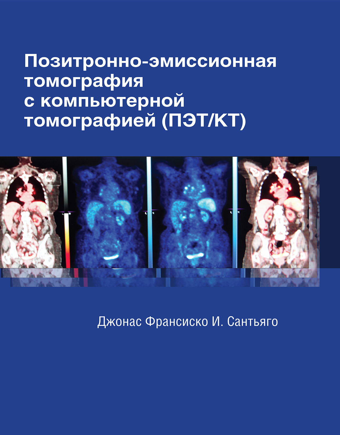 Позитронно-эмиссионная томография с компьютерной томографией