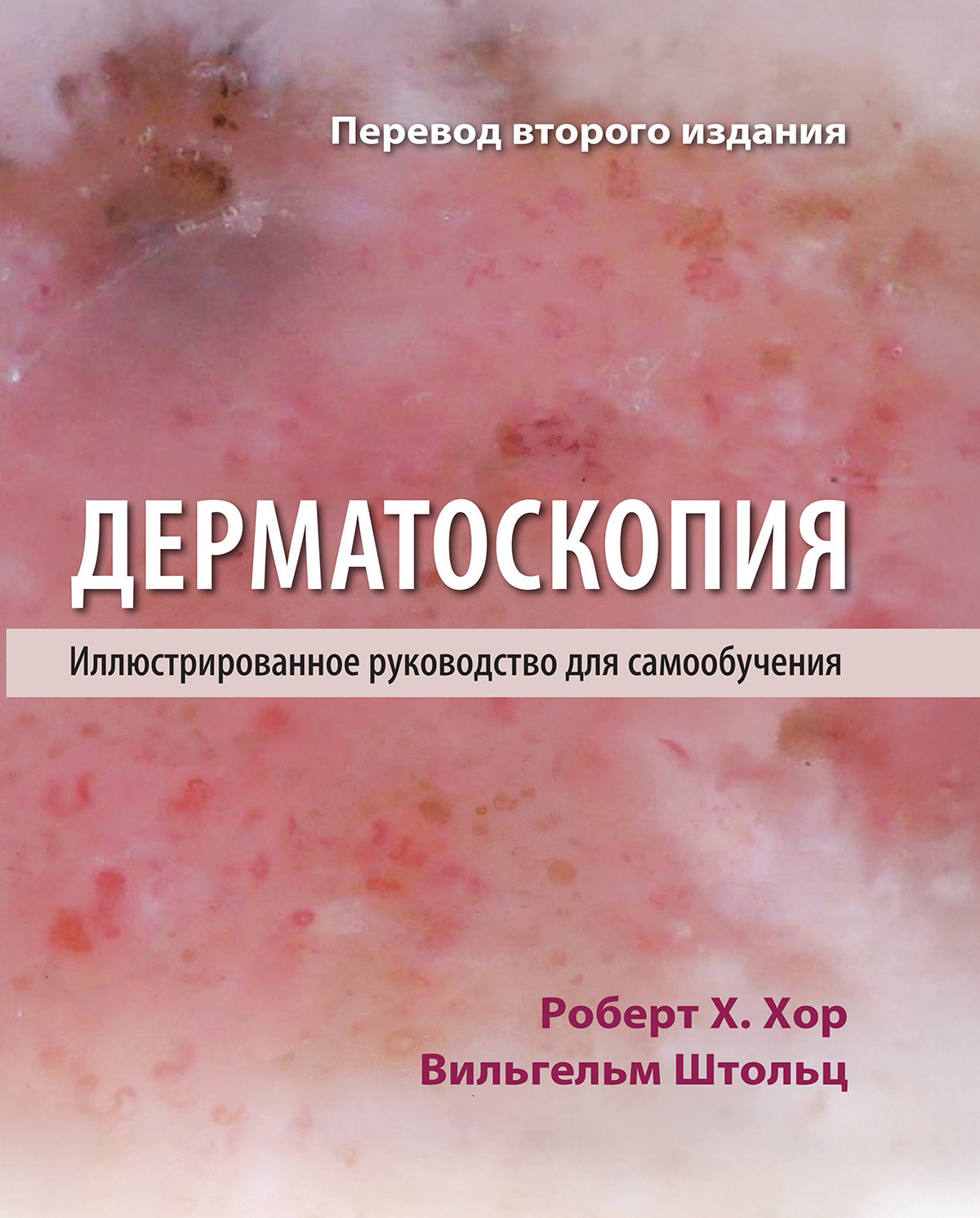 Дерматоскопия. Иллюстрированное руководство для самообучения