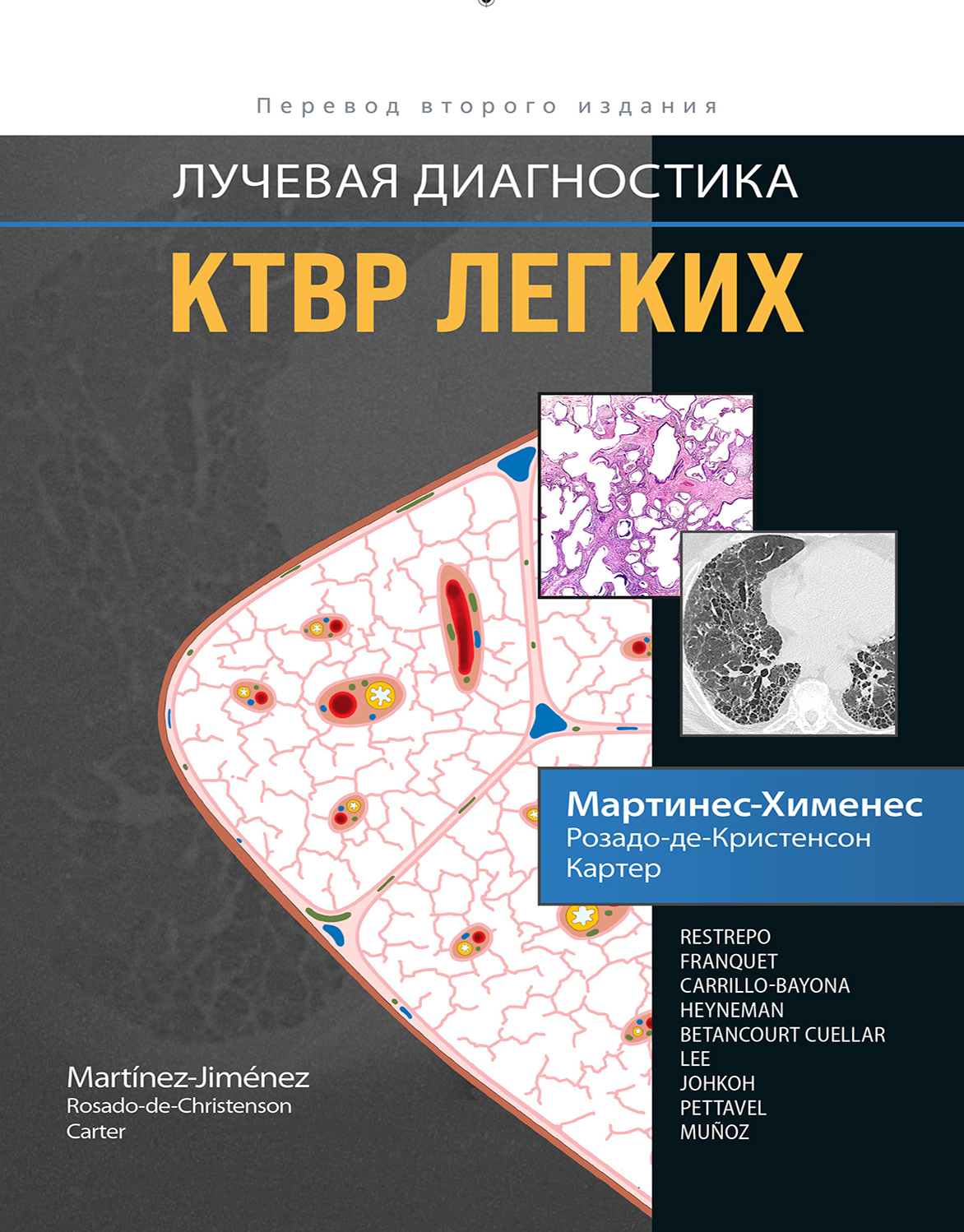 Лучевая диагностика. КТВР легких