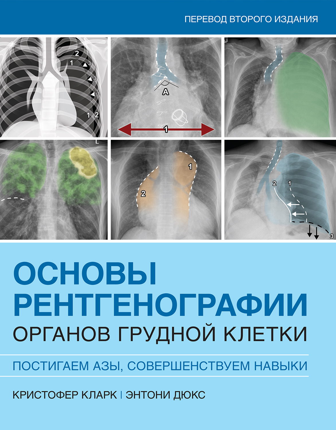 Основы рентгенографии органов грудной клетки