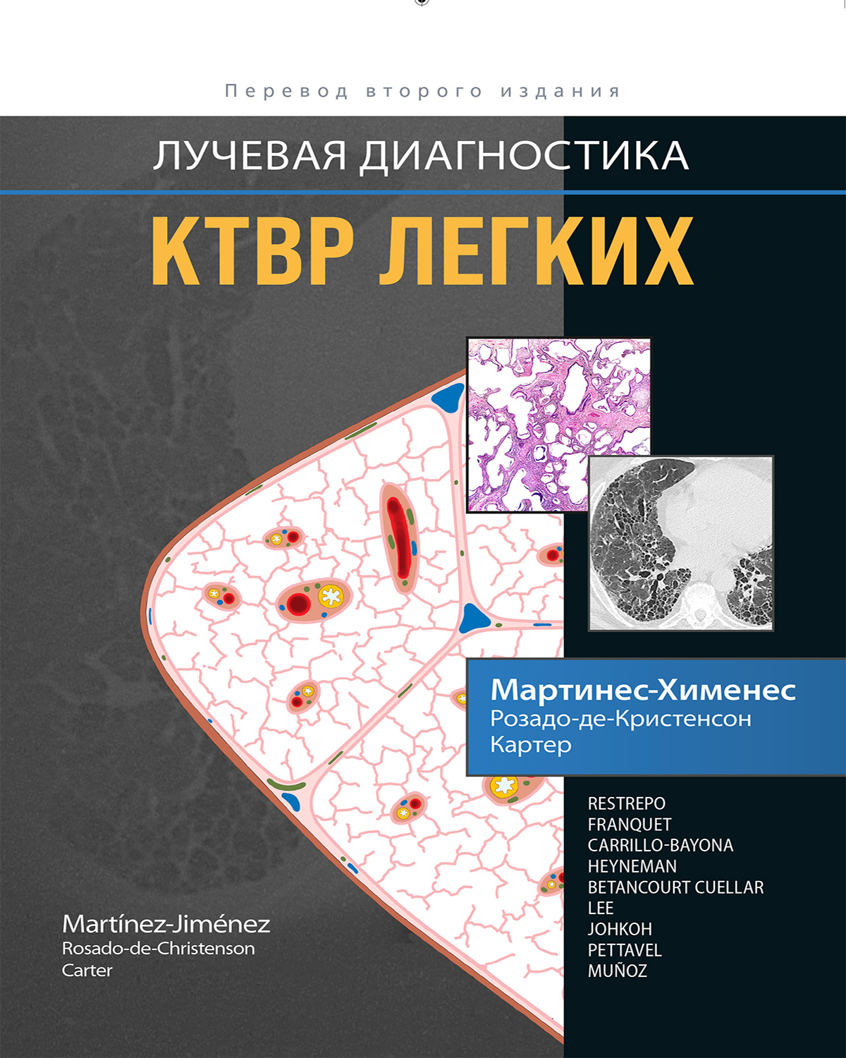 Лучевая диагностика. КТВР легких