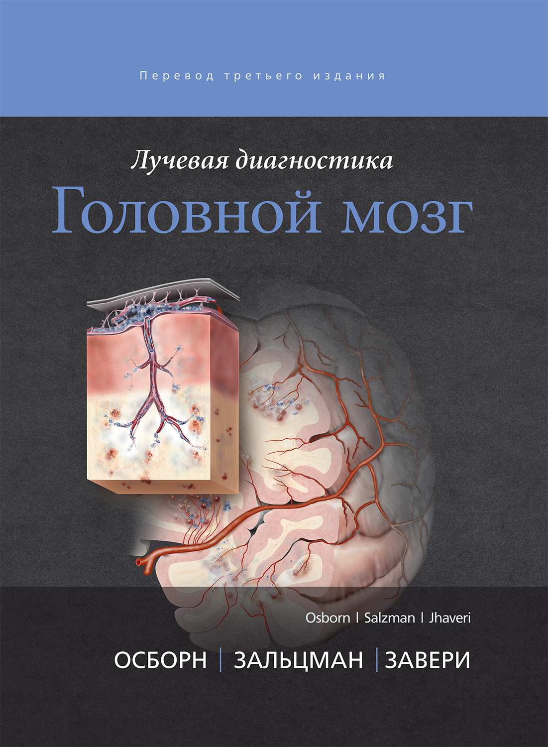 Лучевая диагностика. Головной мозг  диагностика. Голова и шея