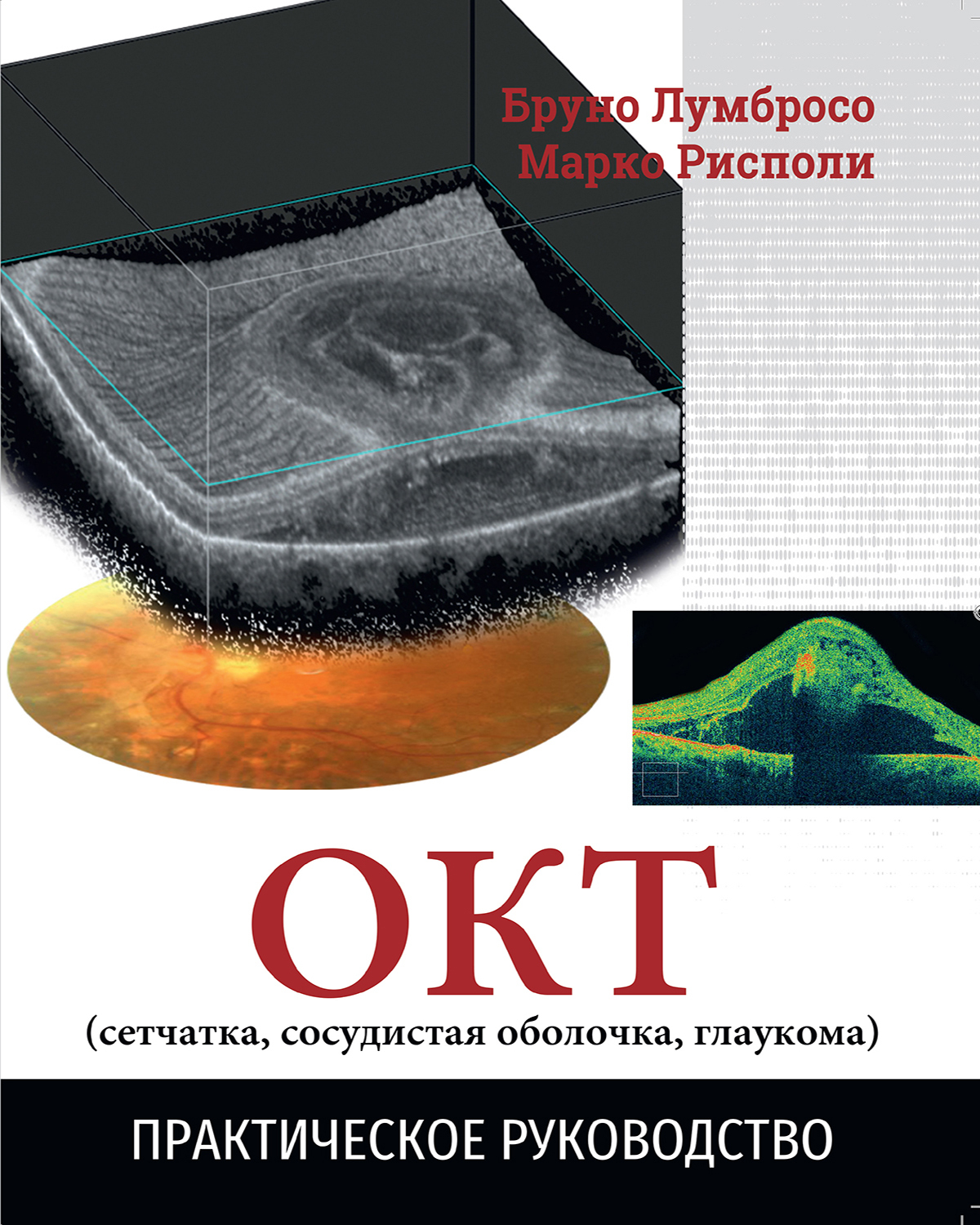 Оптическая когерентная томография (сетчатка, сосудистая оболочка, глаукома)