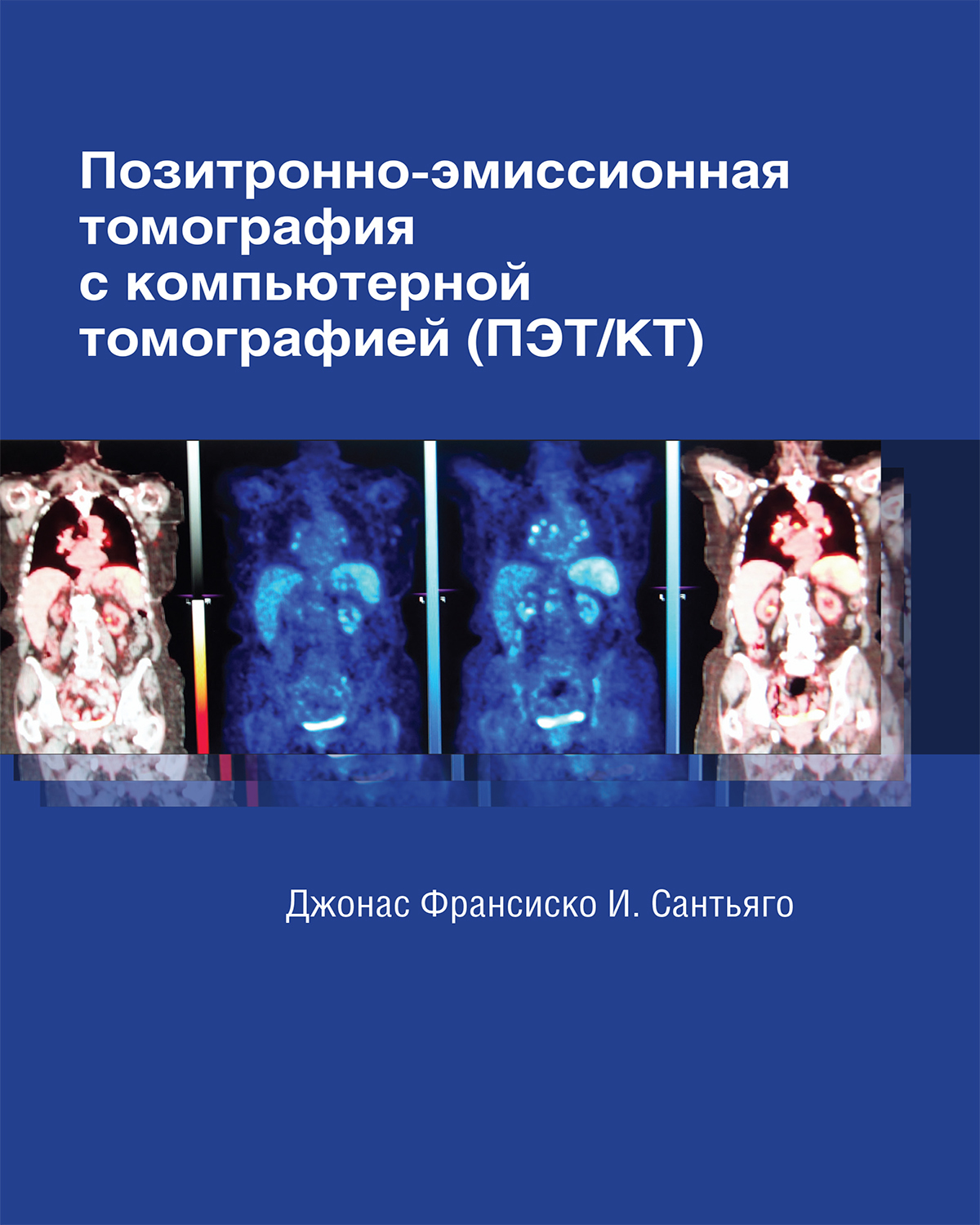 Позитронно-эмиссионная томография с компьютерной томографией