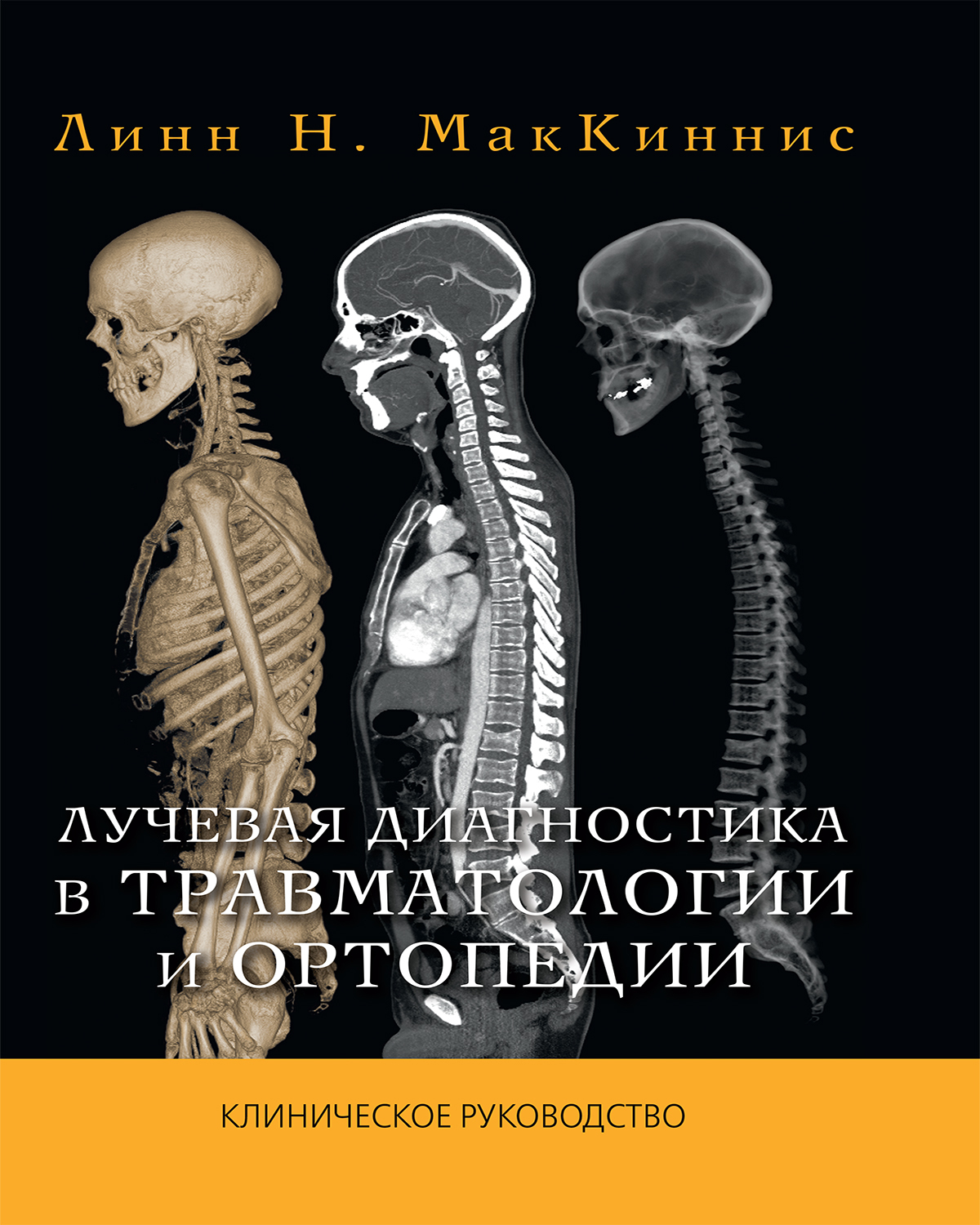 Лучевая диагностика в травматологии и ортопедии. Клиническое руководство